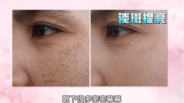 零姿美白祛斑抗皺霜 面部淡紋補水保濕 用這一罐就夠了！縮短美白週期 源頭卓效淡斑 - 11