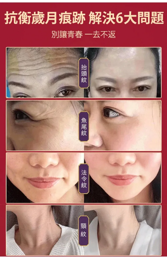 零姿美白祛斑抗皺霜 面部淡紋補水保濕 用這一罐就夠了！縮短美白週期 源頭卓效淡斑 - 23