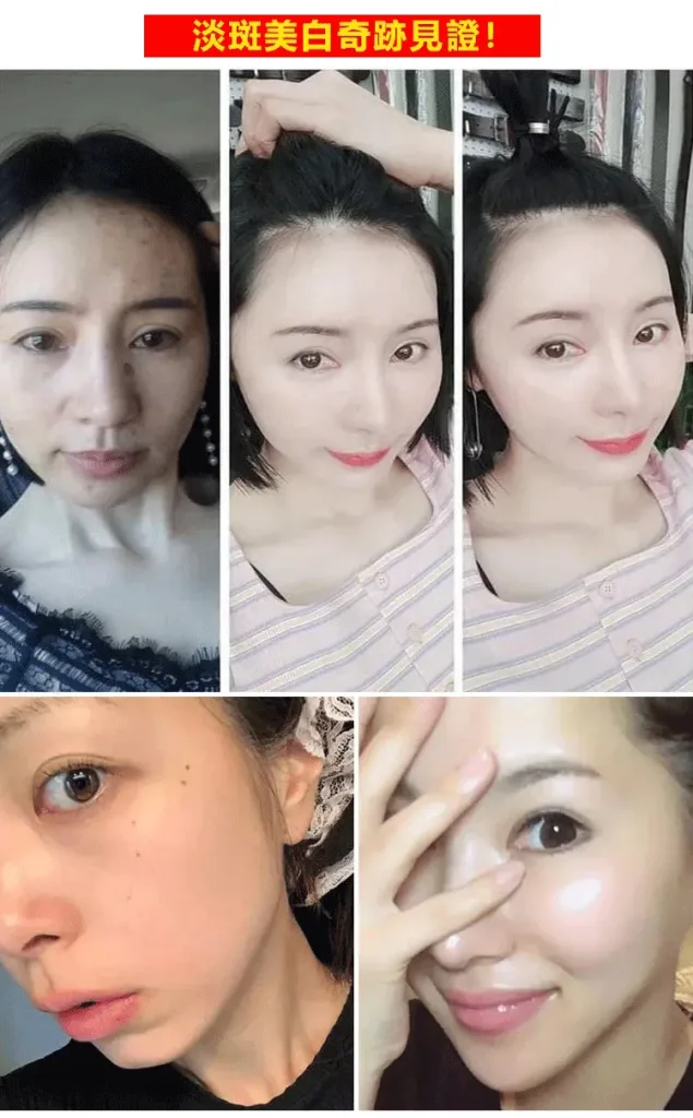 零姿美白祛斑抗皺霜 面部淡紋補水保濕 用這一罐就夠了！縮短美白週期 源頭卓效淡斑 - 10