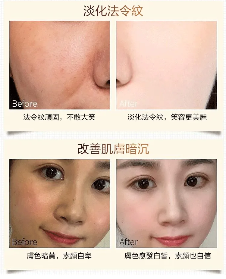 零姿美白祛斑抗皺霜 面部淡紋補水保濕 用這一罐就夠了！縮短美白週期 源頭卓效淡斑 - 17